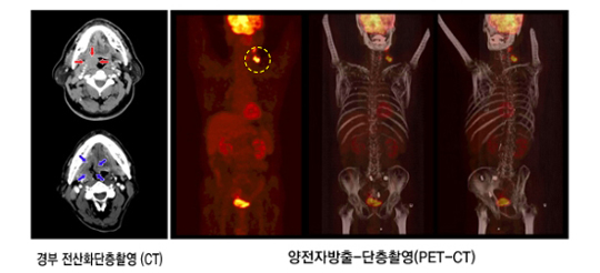 치료전 필요한 검사들