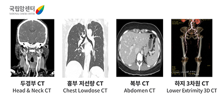 [국립암센터] 두경부(Head&Neck CT) CT / 흉부 저선량(Chest Lowdose CT) CT / 복부(Abodomen CT) CT / 하지 3차원(Lower Extrimity 3D CT) CT