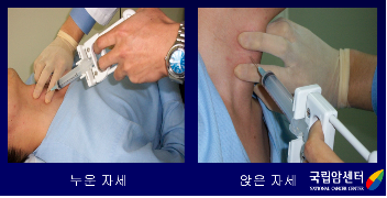 누운자세와 앉은자세의 갑상선암의 미세침흡인세포검사